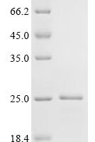 Cricetulus griseus Uncharacterized protein Recombinant Protein - BioCrest Sci