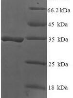 Human DAN domain family member 5 (DAND5) Recombinant Protein - BioCrest Sci