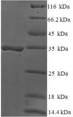 Human DAN domain family member 5 (DAND5) Recombinant Protein, Homo sapiens (Human), E.coli, N-terminal 6xHis-SUMO-tagged, 34.1 kDa, purity >≥ 90% as determined by SDS-PAGE.