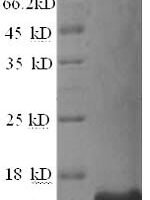 Rat Prolactin-inducible protein homolog (Pip) Recombinant Protein - BioCrest Sci