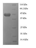 Bacillus sp. Monomeric sarcosine oxidase (soxA) Recombinant Protein - BioCrest Sci