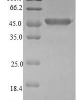 Human Cysteine dioxygenase type 1 (CDO1) Recombinant Protein, N-GST - BioCrest Sci