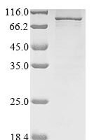 Human Semaphorin-3B (SEMA3B) Recombinant Protein, N-10His/C-Myc - BioCrest Sci