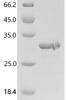 Human Tetranectin (CLEC3B) Recombinant Protein - BioCrest Sci