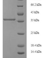 Human Phosphatidylinositol-glycan biosynthesis class X protein (PIGX), partial Recombinant Protein - BioCrest Sci