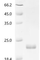 Human Interleukin-6 (IL6) Recombinant Protein, Tag-Free - BioCrest Sci