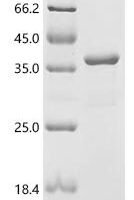 Human Tyrosine-protein kinase BTK (BTK)(C481S), partial Recombinant Protein - BioCrest Sci