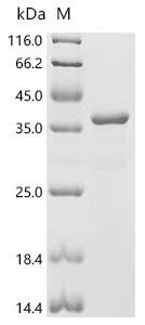 Human Tyrosine-protein kinase BTK (BTK)(C481S), partial Recombinant Protein, Homo sapiens (Human), E.coli, C-terminal 6xHis-tagged, 37.7 kDa, purity >≥ 95% as determined by SDS-PAGE.