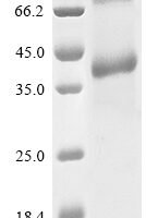 Human CAMPATH-1 antigen (CD52), partial Recombinant Protein, C-hFc1 - BioCrest Sci