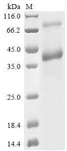 Human CAMPATH-1 antigen (CD52), partial Recombinant Protein, C-hFc1, Homo sapiens (Human), Mammalian cell, C-terminal hFc1-tagged, 30.1 kDa, purity >≥ 85% as determined by SDS-PAGE.