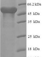 Human THAP domain-containing protein 11 (THAP11), partial Recombinant Protein - BioCrest Sci