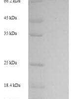 Human Glycerol kinase 2 (GK2), partial Recombinant Protein - BioCrest Sci