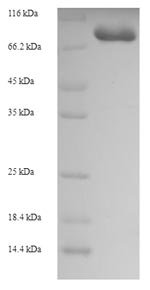 Human Glycerol kinase 2 (GK2), partial Recombinant Protein, Homo sapiens (Human), E.coli, N-terminal 6xHis-SUMO-tagged, 76.5 kDa, purity >≥ 90% as determined by SDS-PAGE.