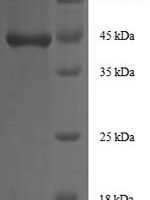 Human Insulin-like growth factor I (IGF1) Recombinant Protein, N-GST - BioCrest Sci