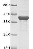 Neisseria meningitidis serogroup B Major outer membrane protein P.IB (porB) Recombinant Protein, N-His, aa 20–331, UniProt P30689 - BioCrest Sci