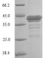 Human Gastrotropin (FABP6) Recombinant Protein - BioCrest Sci