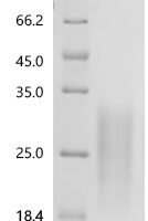 Human Transmembrane and immunoglobulin domain-containing protein 2 (TMIGD2), partial Recombinant Protein, C-10His - BioCrest Sci