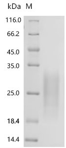 Human Transmembrane and immunoglobulin domain-containing protein 2 (TMIGD2), partial Recombinant Protein, C-10His, Homo sapiens (Human), Mammalian cell, C-terminal 10xHis-tagged, 15.4 kDa, purity >≥ 95% as determined by SDS-PAGE.