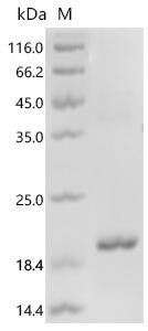 Mouse Glycoprotein hormones alpha chain (Cga) Recombinant Protein, Mus musculus (Mouse), E.coli, C-terminal 6xHis-tagged, 17.6 kDa, purity >≥ 85% as determined by SDS-PAGE.
