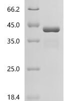 Human Prickle-like protein 2 (PRICKLE2), partial Recombinant Protein, C-His - BioCrest Sci