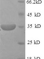 Mouse Pituitary homeobox 3 (Pdia2) Recombinant Protein - BioCrest Sci