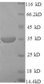 Mouse Pituitary homeobox 3 (Pdia2) Recombinant Protein, Mus musculus (Mouse), Yeast, N-terminal 6xHis-tagged, 33.7 kDa, purity >≥ 90% as determined by SDS-PAGE.