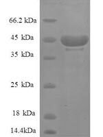 Human 40S ribosomal protein S14 (RPS14), partial Recombinant Protein - BioCrest Sci