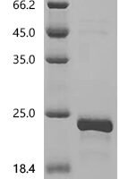 Bovine Transthyretin (TTR) Recombinant Protein, C-His, aa 21–147, E.coli - BioCrest Sci