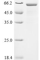 Human CCR4-NOT transcription complex subunit 6-like (CNOT6L) Recombinant Protein - BioCrest Sci
