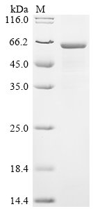Human CCR4-NOT transcription complex subunit 6-like (CNOT6L) Recombinant Protein, Homo sapiens (Human), E.coli, N-terminal 6xHis-tagged, 67.1 kDa, purity >≥ 85% as determined by SDS-PAGE.