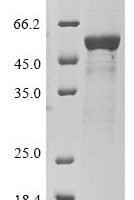 Human Atrial natriuretic peptide receptor 2 (NPR2), partial Recombinant Protein, N-His - BioCrest Sci