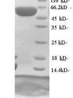 Human Dihydropyrimidinase-related protein 1 (CRMP1) Recombinant Protein, N-His - BioCrest Sci