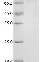 Human SWI/SNF-related matrix-associated actin-dependent regulator of chromatin subfamily A member 4 (SMARCA4), partial, Biotinylated Recombinant Protein - BioCrest Sci