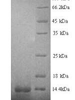 Human Early growth response protein 1 (EGR1), partial Recombinant Protein, N-His - BioCrest Sci