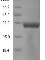 Mycoplasma pneumoniae Chaperone protein DnaK (dnaK), partial Recombinant Protein - BioCrest Sci