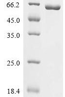 Human 3-hydroxy-3-methylglutaryl-coenzyme A reductase (HMGCR), partial Recombinant Protein, C-His - BioCrest Sci