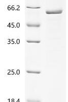 Human Inactive hydroxysteroid dehydrogenase-like protein 1 (HSDL1) Recombinant Protein - BioCrest Sci