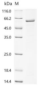 Human Inactive hydroxysteroid dehydrogenase-like protein 1 (HSDL1) Recombinant Protein, Homo sapiens (Human), E.coli, N-terminal GST-tagged, 64.3 kDa, purity >≥ 85% as determined by SDS-PAGE.