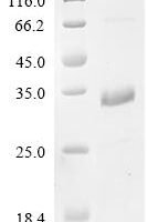 Mouse WAP four-disulfide core domain protein 2 (Wfdc2) Recombinant Protein - BioCrest Sci