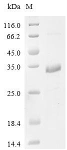 Mouse WAP four-disulfide core domain protein 2 (Wfdc2) Recombinant Protein, Mus musculus (Mouse), E.coli, C-terminal 10xHis-tagged, 23.5 kDa, purity >≥ 85% as determined by SDS-PAGE.