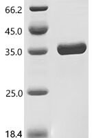 Streptococcus equi subsp. zooepidemicus IgG endopeptidase (ideZ) Recombinant Protein - BioCrest Sci