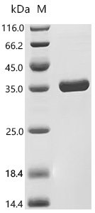 Streptococcus equi subsp. zooepidemicus IgG endopeptidase (ideZ) Recombinant Protein, Streptococcus equi subsp. zooepidemicus, E.coli, N-terminal 12xHis-tagged, 37.3 kDa, purity >≥ 95% as determined by SDS-PAGE.