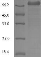 Human Plastin-2 (LCP1) Recombinant Protein, N-10His - BioCrest Sci