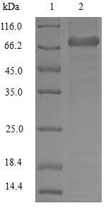 Human Plastin-2 (LCP1) Recombinant Protein, N-10His, Homo sapiens(Human), Baculovirus, N-terminal 10xHis-tagged, 72.7 kDa, purity >≥ 85% as determined by SDS-PAGE.