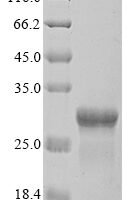 Klebsiella pneumoniae Outer membrane protein A (ompA), partial Recombinant Protein, N-10His/C-Myc - BioCrest Sci