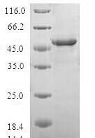 Human CCN family member 5 (CCN5) Recombinant Protein, N-GST - BioCrest Sci