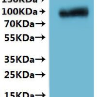 Crimean-Congo hemorrhagic fever virus Envelope glycoprotein (GP), partial-VLPs Recombinant Protein - BioCrest Sci