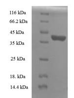 Human Ropporin-1B (ROPN1B), partial Recombinant Protein - BioCrest Sci