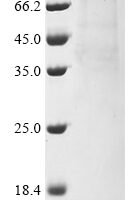 Human DNA polymerase theta (POLQ), partial Recombinant Protein, N-10His/C-Flag, aa 1820–2590 - BioCrest Sci