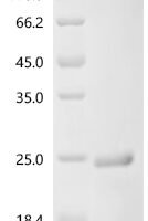 Escherichia coli Chemotaxis protein CheY (cheY) Recombinant Protein - BioCrest Sci